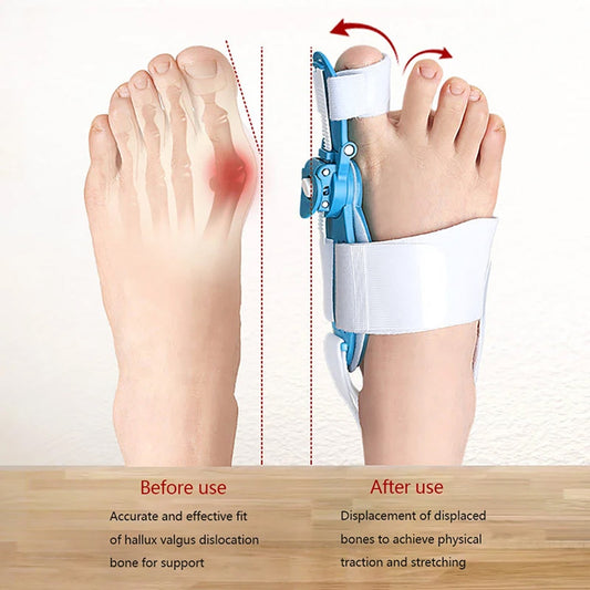 12738 Bunion Support Splint. Valgus And Bunion Valgus Corrector Hallux Valgus Corrector Adjustable Bunion Valgus Protective Cover For Men And Women - Zidbik